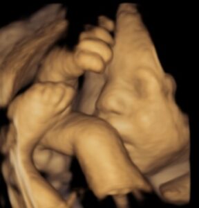 A high-resolution 3D ultrasound image of a baby’s face, legs, arms captured at Sneak-a-Pic Ultrasound & Spa in Sugar Land near Houston