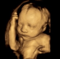 Clear 3D ultrasound image of baby face HD Live