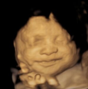 Baby smiling in 3D ultrasound captured at Sneak-a-Pic in Sugar Land, TX